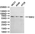Western Blot
Positive WB detected in: MCF7 whole cell lysate(30µg), A549 whole cell lysate(30µg), A549 whole cell lysate(30µg), HT-29 whole cell lysate(30µg)
All lanes:TERF2 antibody at 1:1000
Secondary
Goat polyclonal to rabbit IgG at 1/40000 dilution
Predicted band size: 60 kDa
Observed band size: 66 kDa
Exposure time：2min