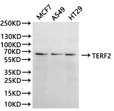 Western Blot
Positive WB detected in: MCF7 whole cell lysate(30µg), A549 whole cell lysate(30µg), A549 whole cell lysate(30µg), HT-29 whole cell lysate(30µg)
All lanes:TERF2 antibody at 1:1000
Secondary
Goat polyclonal to rabbit IgG at 1/40000 dilution
Predicted band size: 60 kDa
Observed band size: 66 kDa
Exposure time：2min