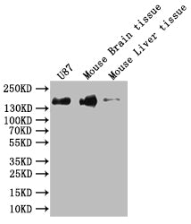 Western Blot
Positive WB detected in: Hela whole cell lysate, K562 whole cell lysate, U-87 whole cell lysate, Mouse Brain whole cell lysate
All lanes: SF3B1 antibody at 1:1000
Secondary
Goat polyclonal to rabbit IgG at 1/50000 dilution
Predicted band size: 146, 17 kDa
Observed band size: 130 kDa