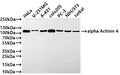 Western Blot
Positive WB detected in: HeLa whole cell lysate(30µg) , U-251MG whole cell lysate(30µg) , A-431 whole cell lysate(30µg) , COLO205 whole cell lysate(30µg) , PC-3 whole cell lysate(30µg) , NIH/3T3 whole cell lysate(30µg) , Jurkat whole cell lysate(30µg) 
All lanes: ACTN4  antibody at 1:1000
Secondary
Goat polyclonal to rabbit IgG at 1/50000 dilution
Predicted band size: 105 kDa
Observed band size: 105 kDa
Exposure time: 1min