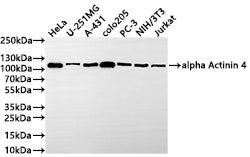 Western Blot
Positive WB detected in: HeLa whole cell lysate(30µg) , U-251MG whole cell lysate(30µg) , A-431 whole cell lysate(30µg) , COLO205 whole cell lysate(30µg) , PC-3 whole cell lysate(30µg) , NIH/3T3 whole cell lysate(30µg) , Jurkat whole cell lysate(30µg) 
All lanes: ACTN4  antibody at 1:1000
Secondary
Goat polyclonal to rabbit IgG at 1/50000 dilution
Predicted band size: 105 kDa
Observed band size: 105 kDa
Exposure time: 1min