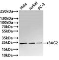Western Blot
Positive WB detected in: Hela whole cell lysate(30µg) , Jurkat whole cell lysate(30µg) , PC-3 whole cell lysate(30µg) 
All lanes: BAG2 antibody at 1:1000
Secondary
Goat polyclonal to rabbit IgG at 1/40000 dilution
Predicted band size: 24 kDa
Observed band size: 24 kDa
Exposure time：1min