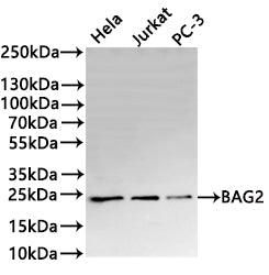 Western Blot
Positive WB detected in: Hela whole cell lysate(30µg) , Jurkat whole cell lysate(30µg) , PC-3 whole cell lysate(30µg) 
All lanes: BAG2 antibody at 1:1000
Secondary
Goat polyclonal to rabbit IgG at 1/40000 dilution
Predicted band size: 24 kDa
Observed band size: 24 kDa
Exposure time：1min