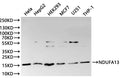 Western Blot, 
Positive WB detected in: Hela whole cell lysate(30µg), HepG2 whole cell lysate(30µg), HEK293 whole cell lysate(30µg), MCF7 whole cell lysate(30µg), U251 whole cell lysate(30µg), THP-1 whole cell lysate(30µg)
All lanes: NDUFA13 antibody at 1:1000
Secondary
Goat polyclonal to rabbit IgG at 1/40000 dilution
Predicted band size: 17 kDa
Observed band size: 17 kDa
Exposure time：120s