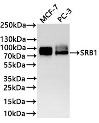 Western Blot
Positive WB detected in: MCF-7 whole cell lysate(30µg) , PC-3 whole cell lysate(30µg) 
All lanes: SRB1 antibody at 1:1000
Secondary
Goat polyclonal to rabbit IgG at 1/40000 dilution
Predicted band size: 61 kDa
Observed band size: 80/90 kDa
Exposure time：2min