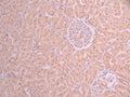 IHC image of CSB-RA105164A0HU diluted at 1:100 and staining in paraffin-embedded human kidney tissue performed on a Leica BondTM system. After dewaxing and hydration, antigen retrieval was mediated by high pressure in a citrate buffer (pH 6.0) . Section was blocked with 10% normal goat serum 30min at RT. Then primary antibody (1% BSA) was incubated at 4°C overnight. The primary is detected by a Goat anti-rabbit polymer IgG labeled by HRP and visualized using 0.05% DAB.
