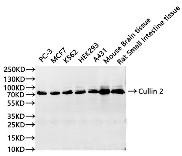 Western Blot, 
Positive WB detected in:PC-3 whole cell lysate(30µg), MCF7 whole cell lysate(30µg), K562 whole cell lysate(30µg), HEK293 whole cell lysate(30µg), A431 whole cell lysate(30µg), Mouse brain tissue lysate(30µg), Rat Small intestine lysate(30µg)
All lanes: Cullin 2 antibody at 1:1000
Secondary
Goat polyclonal to rabbit IgG at 1/40000 dilution
Predicted band size: 87 kDa
Observed band size: 87 kDa
Exposure time：120s