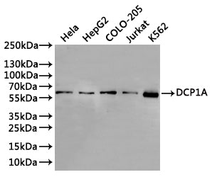Western Blot
Positive WB detected in: Hela whole cell lysate(30µg), HepG2 whole cell lysate(30µg), COLO-205 whole cell lysate(30µg), Jurkat whole cell lysate(30µg), k562 whole cell lysate(30µg)
All lanes: DCP1A antibody at 1:1000
Secondary
Goat polyclonal to rabbit IgG at 1/40000 dilution
Predicted band size: 63 kDa
Observed band size: 63 kDa
Exposure time：2min