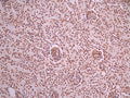 IHC image of CSB-RA109932A0HU diluted at 1:100 and staining in paraffin-embedded mouse kidney tissue performed on a Leica BondTM system. After dewaxing and hydration, antigen retrieval was mediated by high pressure in a citrate buffer (pH 6.0). Section was blocked with 10% normal goat serum 30min at RT. Then primary antibody (1% BSA) was incubated at 4°C overnight. The primary is detected by a Goat anti-rabbit polymer IgG labeled by HRP and visualized using 0.05% DAB.