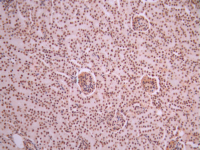 IHC image of CSB-RA109932A0HU diluted at 1:100 and staining in paraffin-embedded mouse kidney tissue performed on a Leica BondTM system. After dewaxing and hydration, antigen retrieval was mediated by high pressure in a citrate buffer (pH 6.0). Section was blocked with 10% normal goat serum 30min at RT. Then primary antibody (1% BSA) was incubated at 4°C overnight. The primary is detected by a Goat anti-rabbit polymer IgG labeled by HRP and visualized using 0.05% DAB.