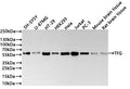 Western Blot
Positive WB detected in: SH-SY5Y whole cell lysate(30µg) , U-87MG whole cell lysate(30µg) , HT-29 whole cell lysate(30µg) , HEK293 whole cell lysate(30µg) , Hela whole cell lysate(30µg) , Jurkat whole cell lysate(30µg) , PC-3 whole cell lysate(30µg) , Mouse brain tissue lysate(30µg) , Rat brain tissue lysate(30µg) 
All lanes: TFG antibody at 1:1000
Secondary
Goat polyclonal to rabbit IgG at 1/40000 dilution
Predicted band size: 43 kDa
Observed band size: 56 kDa
Exposure time：2min