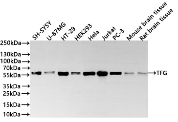 Western Blot
Positive WB detected in: SH-SY5Y whole cell lysate(30µg) , U-87MG whole cell lysate(30µg) , HT-29 whole cell lysate(30µg) , HEK293 whole cell lysate(30µg) , Hela whole cell lysate(30µg) , Jurkat whole cell lysate(30µg) , PC-3 whole cell lysate(30µg) , Mouse brain tissue lysate(30µg) , Rat brain tissue lysate(30µg) 
All lanes: TFG antibody at 1:1000
Secondary
Goat polyclonal to rabbit IgG at 1/40000 dilution
Predicted band size: 43 kDa
Observed band size: 56 kDa
Exposure time：2min