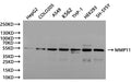 Western Blot, 
Positive WB detected in:HepG2 whole cell lysate(30µg), COLO205 whole cell lysate(30µg), A549 whole cell lysate(30µg), K562 whole cell lysate(30µg), THP-1 whole cell lysate(30µg), HEK293 whole cell lysate(30µg), SH-SY5Y whole cell lysate(30µg)
All lanes: MMP11 antibody at 1:1000
Secondary
Goat polyclonal to rabbit IgG at 1/40000 dilution
Predicted band size: 55 kDa
Observed band size: 55 kDa
Exposure time：120s