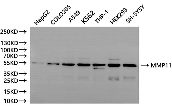 Western Blot, 
Positive WB detected in:HepG2 whole cell lysate(30µg), COLO205 whole cell lysate(30µg), A549 whole cell lysate(30µg), K562 whole cell lysate(30µg), THP-1 whole cell lysate(30µg), HEK293 whole cell lysate(30µg), SH-SY5Y whole cell lysate(30µg)
All lanes: MMP11 antibody at 1:1000
Secondary
Goat polyclonal to rabbit IgG at 1/40000 dilution
Predicted band size: 55 kDa
Observed band size: 55 kDa
Exposure time：120s