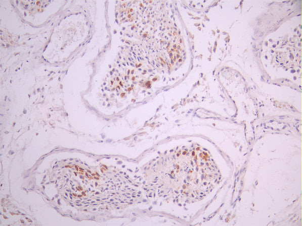 IHC image of CSB-RA112927A0HU diluted at 1:100 and staining in paraffin-embedded human testis tissue performed on a Leica BondTM system. After dewaxing and hydration, antigen retrieval was mediated by high pressure in a citrate buffer (pH 6.0). Section was blocked with 10% normal goat serum 30min at RT. Then primary antibody (1% BSA) was incubated at 4°C overnight. The primary is detected by a Goat anti-rabbit polymer IgG labeled by HRP and visualized using 0.05% DAB.