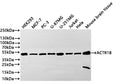 Western Blot
Positive WB detected in: HEK293 whole cell lysate(20µg) ,MCF-7 whole cell lysate(20µg) , PC-3 whole cell lysate(20µg) , U-87MG whole cell lysate(20µg) ,U-251MG whole cell lysate(20µg) ,Jurkat whole cell lysate(20µg) ,Hela whole cell lysate(20µg) , Mouse brain tissue lysate(20µg) 
All lanes: ACTR1B antibody at 1:1000
Secondary
Goat polyclonal to rabbit IgG at 1/40000 dilution
Predicted band size: 42 kDa
Observed band size: 42 kDa
Exposure time：2min