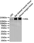 Western Blot
Positive WB detected in: LO2 whole cell lysate(30µg), Rat skeletal muscle tissue lysate(30µg), Mouse tongue tissue lysate(30µg)
All lanes: AGL antibody at 1:1000
Secondary
Goat polyclonal to rabbit IgG at 1/40000 dilution
Predicted band size: 175 kDa
Observed band size: 175 kDa
Exposure time：2min
