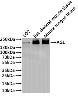 Western Blot
Positive WB detected in: LO2 whole cell lysate(30µg), Rat skeletal muscle tissue lysate(30µg), Mouse tongue tissue lysate(30µg)
All lanes: AGL antibody at 1:1000
Secondary
Goat polyclonal to rabbit IgG at 1/40000 dilution
Predicted band size: 175 kDa
Observed band size: 175 kDa
Exposure time：2min