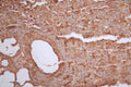 IHC image of CSB-RA116135A0HU diluted at 1:50 and staining in paraffin-embedded mouse lung tissue performed on a Leica BondTM system. After dewaxing and hydration, antigen retrieval was mediated by high pressure in a citrate buffer (pH 6.0) . Section was blocked with 10% normal goat serum 30min at RT. Then primary antibody (1% BSA) was incubated at 4°C overnight. The primary is detected by a Goat anti-rabbit polymer IgG labeled by HRP and visualized using 0.53% DAB.