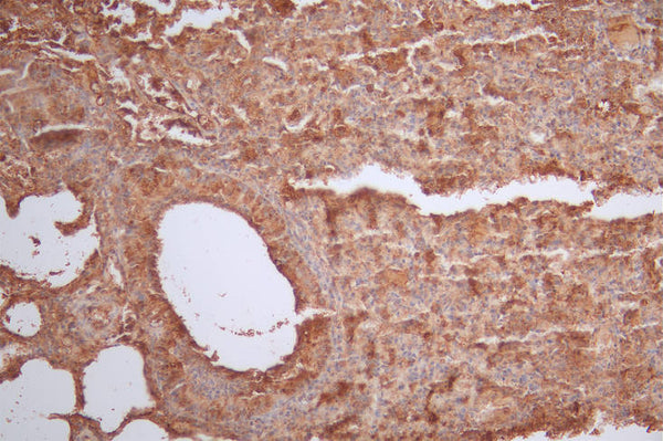 IHC image of CSB-RA116135A0HU diluted at 1:50 and staining in paraffin-embedded mouse lung tissue performed on a Leica BondTM system. After dewaxing and hydration, antigen retrieval was mediated by high pressure in a citrate buffer (pH 6.0) . Section was blocked with 10% normal goat serum 30min at RT. Then primary antibody (1% BSA) was incubated at 4°C overnight. The primary is detected by a Goat anti-rabbit polymer IgG labeled by HRP and visualized using 0.53% DAB.