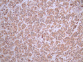 IHC image of CSB-RA118372A0HU diluted at 1:100 and staining in paraffin-embedded human breast cancer performed on a Leica BondTM system. After dewaxing and hydration, antigen retrieval was mediated by high pressure in a citrate buffer (pH 6.0). Section was blocked with 10% normal goat serum 30min at RT. Then primary antibody (1% BSA) was incubated at 4°C overnight. The primary is detected by a Goat anti-rabbit polymer IgG labeled by HRP and visualized using 0.05% DAB.