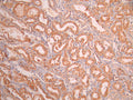 IHC image of CSB-RA118695A0HU diluted at 1:100 and staining in paraffin-embedded human kidney tissue performed on a Leica BondTM system. After dewaxing and hydration, antigen retrieval was mediated by high pressure in a citrate buffer (pH 6.0). Section was blocked with 10% normal goat serum 30min at RT. Then primary antibody (1% BSA) was incubated at 4°C overnight. The primary is detected by a Goat anti-rabbit polymer IgG labeled by HRP and visualized using 0.05% DAB.