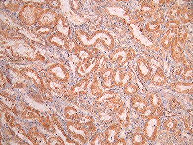 IHC image of CSB-RA118695A0HU diluted at 1:100 and staining in paraffin-embedded human kidney tissue performed on a Leica BondTM system. After dewaxing and hydration, antigen retrieval was mediated by high pressure in a citrate buffer (pH 6.0). Section was blocked with 10% normal goat serum 30min at RT. Then primary antibody (1% BSA) was incubated at 4°C overnight. The primary is detected by a Goat anti-rabbit polymer IgG labeled by HRP and visualized using 0.05% DAB.
