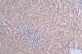 IHC image of CSB-RA119753A0HU diluted at 1:50 and staining in paraffin-embedded human liver cancer performed on a Leica BondTM system. After dewaxing and hydration, antigen retrieval was mediated by high pressure in a citrate buffer (pH 6.0) . Section was blocked with 10% normal goat serum 30min at RT. Then primary antibody (1% BSA) was incubated at 4°C overnight. The primary is detected by a Goat anti-rabbit polymer IgG labeled by HRP and visualized using 0.31% DAB.