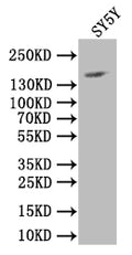 Western BlotPositive WB detected in: SY5Y whole cell lysateAll lanes: NCAM antibody at 1:1000SecondaryGoat polyclonal to rabbit IgG at 1/50000 dilutionPredicted band size: 120-220 kDaObserved band size: 150 kDa
