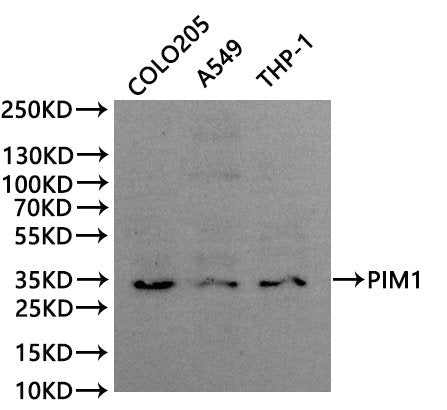 Western Blot, 
Positive WB detected in:COLO205 whole cell lysate(30µg), A549 whole cell lysate(30µg), THP-1 whole cell lysate(30µg)
All lanes: PIM1 antibody at 1:1000
Secondary
Goat polyclonal to rabbit IgG at 1/40000 dilution
Predicted band size: 36 kDa
Observed band size: 32 kDa
Exposure time：300s