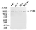 Western Blot, 
Positive WB detected in:A431 whole cell lysate(30µg), A375 whole cell lysate(30µg), U251 whole cell lysate(30µg), SH-SY5Y whole cell lysate(30µg)
All lanes: EPHB3 antibody at 1:1000
Secondary
Goat polyclonal to rabbit IgG at 1/40000 dilution
Predicted band size: 110 kDa
Observed band size: 130 kDa
Exposure time：180s