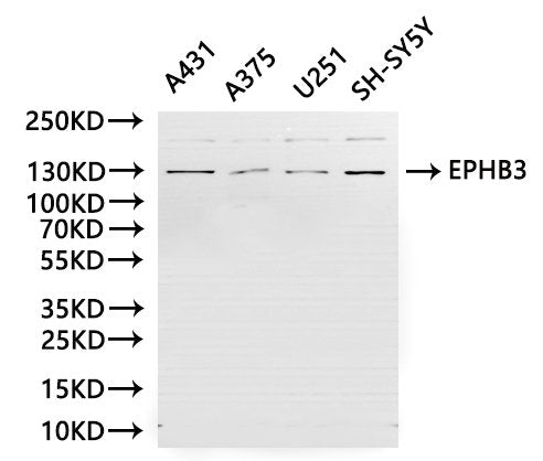 Western Blot, 
Positive WB detected in:A431 whole cell lysate(30µg), A375 whole cell lysate(30µg), U251 whole cell lysate(30µg), SH-SY5Y whole cell lysate(30µg)
All lanes: EPHB3 antibody at 1:1000
Secondary
Goat polyclonal to rabbit IgG at 1/40000 dilution
Predicted band size: 110 kDa
Observed band size: 130 kDa
Exposure time：180s