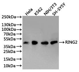 Western Blot
Positive WB detected in: Hela whole cell lysate(30µg), K562 whole cell lysate(30µg), NIH/3T3 whole cell lysate(30µg), SH-SY5Y whole cell lysate(30µg)
All lanes: RING2 antibody at 1:1000
Secondary
Goat polyclonal to rabbit IgG at 1/40000 dilution
Predicted band size: 38 kDa
Observed band size: 38 kDa
Exposure time：2min