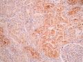 IHC image of CSB-RA124766A0HU diluted at 1:100 and staining in paraffin-embedded human kidney tissue performed on a Leica BondTM system. After dewaxing and hydration, antigen retrieval was mediated by high pressure in a citrate buffer (pH 6.0). Section was blocked with 10% normal goat serum 30min at RT. Then primary antibody (1% BSA) was incubated at 4°C overnight. The primary is detected by a Goat anti-rabbit polymer IgG labeled by HRP and visualized using 0.05% DAB.