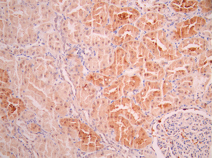IHC image of CSB-RA124766A0HU diluted at 1:100 and staining in paraffin-embedded human kidney tissue performed on a Leica BondTM system. After dewaxing and hydration, antigen retrieval was mediated by high pressure in a citrate buffer (pH 6.0). Section was blocked with 10% normal goat serum 30min at RT. Then primary antibody (1% BSA) was incubated at 4°C overnight. The primary is detected by a Goat anti-rabbit polymer IgG labeled by HRP and visualized using 0.05% DAB.