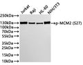 Western Blot
Positive WB detected in: Jurkat whole cell lysate(30µg) , Raji whole cell lysate(30µg) , HL-60 whole cell lysate(30µg) , NIH/3T3 whole cell lysate(30µg) 
All lanes:p-MCM2 (S27) antibody at 1:1000
Secondary
Goat polyclonal to rabbit IgG at 1/40000 dilution
Predicted band size: 102 kDa
Observed band size: 130 kDa
Exposure time：2min