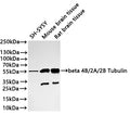 Western Blot
Positive WB detected in: SH-SY5Y whole cell lysate(30µg) , Mouse brain tissue lysate(30µg) , Rat brain tissue lysate(30µg) 
All lanes: beta 4B/2A/2B Tubulin antibody at 1:1000
Secondary
Goat polyclonal to rabbit IgG at 1/40000 dilution
Predicted band size: 50 kDa
Observed band size: 55 kDa
Exposure time：40s