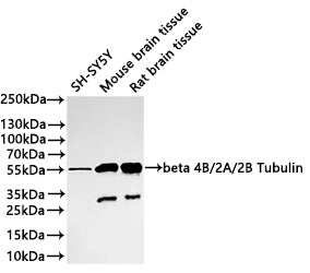 Western Blot
Positive WB detected in: SH-SY5Y whole cell lysate(30µg) , Mouse brain tissue lysate(30µg) , Rat brain tissue lysate(30µg) 
All lanes: beta 4B/2A/2B Tubulin antibody at 1:1000
Secondary
Goat polyclonal to rabbit IgG at 1/40000 dilution
Predicted band size: 50 kDa
Observed band size: 55 kDa
Exposure time：40s