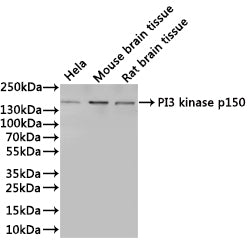 Western Blot
Positive WB detected in: Hela whole cell lysate(30µg), Mouse brain tissue lysate(30µg), Rat brain tissue lysate(30µg)
All lanes: PI3 kinase p150 antibody at 1:1000
Secondary
Goat polyclonal to rabbit IgG at 1/40000 dilution
Predicted band size: 153 kDa
Observed band size: 153 kDa
Exposure time：3min