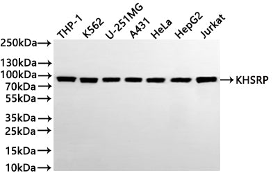Western Blot
Positive WB detected in: THP-1 whole cell lysate(30µg) , K562 whole cell lysate(30µg) , U-251MG whole cell lysate(30µg) , A431 whole cell lysate(30µg) , HeLa whole cell lysate(30µg) , HepG2 whole cell lysate(30µg) , Jurkat whole cell lysate(30µg) 
All lanes: KHSRP antibody at 1:1000
Secondary
Goat polyclonal to rabbit IgG at 1/40000 dilution
Predicted band size: 73 kDa
Observed band size: 62 kDa
Exposure time：1min