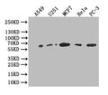 Western Blot
Positive WB detected in: A549 whole cell lysate, U251 whole cell lysate,MCF7 whole cell lysate,HELA whole cell lysate,PC-3 whole cell lysate
All lanes: Glucose 6 phosphate isomerase antibody at 1:1000
Secondary
Goat polyclonal to rabbit IgG at 1/50000 dilution
Predicted band size: 63 kDa
Observed band size: 63 kDa