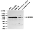 Western Blot, 
Positive WB detected in:A549 whole cell lysate(30µg), COLO205 whole cell lysate(30µg), HEK293 whole cell lysate(30µg), Mouse brain tissue lysate(30µg), Rat brain lysate(30µg)
All lanes: KHDRBS1 antibody at 1:1000
Secondary
Goat polyclonal to rabbit IgG at 1/40000 dilution
Predicted band size: 48 kDa
Observed band size: 68 kDa
Exposure time：20s