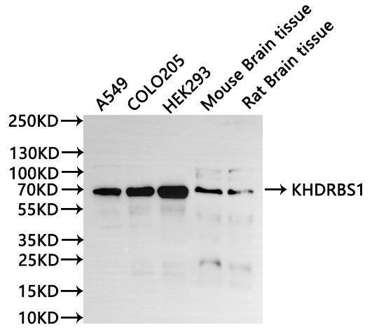 Western Blot, 
Positive WB detected in:A549 whole cell lysate(30µg), COLO205 whole cell lysate(30µg), HEK293 whole cell lysate(30µg), Mouse brain tissue lysate(30µg), Rat brain lysate(30µg)
All lanes: KHDRBS1 antibody at 1:1000
Secondary
Goat polyclonal to rabbit IgG at 1/40000 dilution
Predicted band size: 48 kDa
Observed band size: 68 kDa
Exposure time：20s