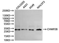 Western Blot, 
Positive WB detected in:COLO205 whole cell lysate(30µg), A431 whole cell lysate(30µg), A549 whole cell lysate(30µg), NIH/3T3 whole cell lysate(30µg)
All lanes: CHMP2B antibody at 1:1000
Secondary
Goat polyclonal to rabbit IgG at 1/40000 dilution
Predicted band size: 24 kDa
Observed band size: 28 kDa
Exposure time：120s