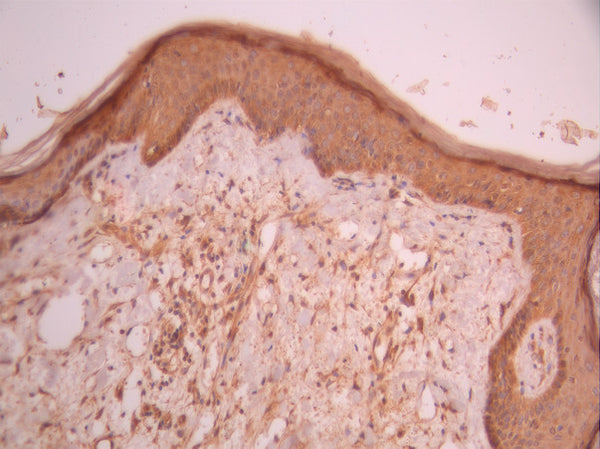 IHC image of CSB-RA131536A0HU diluted at 1:100 and staining in paraffin-embedded human skin tissue performed on a Leica BondTM system. After dewaxing and hydration, antigen retrieval was mediated by high pressure in a citrate buffer (pH 6.0). Section was blocked with 10% normal goat serum 30min at RT. Then primary antibody (1% BSA) was incubated at 4°C overnight. The primary is detected by a Goat anti-rabbit polymer IgG labeled by HRP and visualized using 0.05% DAB.