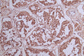IHC image of CSB-RA131953A0HU diluted at 1:33 and staining in paraffin-embedded human testis tissue performed on a Leica BondTM system. After dewaxing and hydration, antigen retrieval was mediated by high pressure in a citrate buffer (pH 6.0) . Section was blocked with 10% normal goat serum 30min at RT. Then primary antibody (1% BSA) was incubated at 4°C overnight. The primary is detected by a Goat anti-rabbit polymer IgG labeled by HRP and visualized using 0.73% DAB.