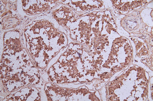 IHC image of CSB-RA131953A0HU diluted at 1:33 and staining in paraffin-embedded human testis tissue performed on a Leica BondTM system. After dewaxing and hydration, antigen retrieval was mediated by high pressure in a citrate buffer (pH 6.0) . Section was blocked with 10% normal goat serum 30min at RT. Then primary antibody (1% BSA) was incubated at 4°C overnight. The primary is detected by a Goat anti-rabbit polymer IgG labeled by HRP and visualized using 0.73% DAB.