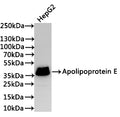 Western Blot
Positive WB detected in: HepG2 whole cell lysate(30µg)
All lanes: Apolipoprotein E antibody at 1:1000
Secondary
Goat polyclonal to rabbit IgG at 1/40000 dilution
Predicted band size: 36 kDa
Observed band size: 36 kDa
Exposure time：3min