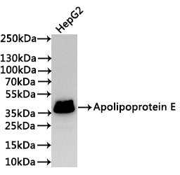 Western Blot
Positive WB detected in: HepG2 whole cell lysate(30µg)
All lanes: Apolipoprotein E antibody at 1:1000
Secondary
Goat polyclonal to rabbit IgG at 1/40000 dilution
Predicted band size: 36 kDa
Observed band size: 36 kDa
Exposure time：3min