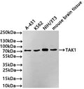 Western Blot
Positive WB detected in: A431 whole cell lysate(30µg) , K562 whole cell lysate(30µg) , NIH/3T3 whole cell lysate(30µg) , Mouse brain tissue lysate(30µg) 
All lanes: TAK1 antibody at 1:1000
Secondary
Goat polyclonal to rabbit IgG at 1/40000 dilution
Predicted band size: 67 kDa
Observed band size: 75 kDa
Exposure time：3min